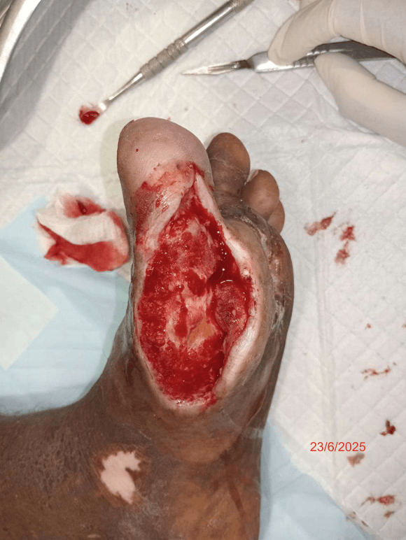 Clinical image 4 from Merina Medical Centre case record