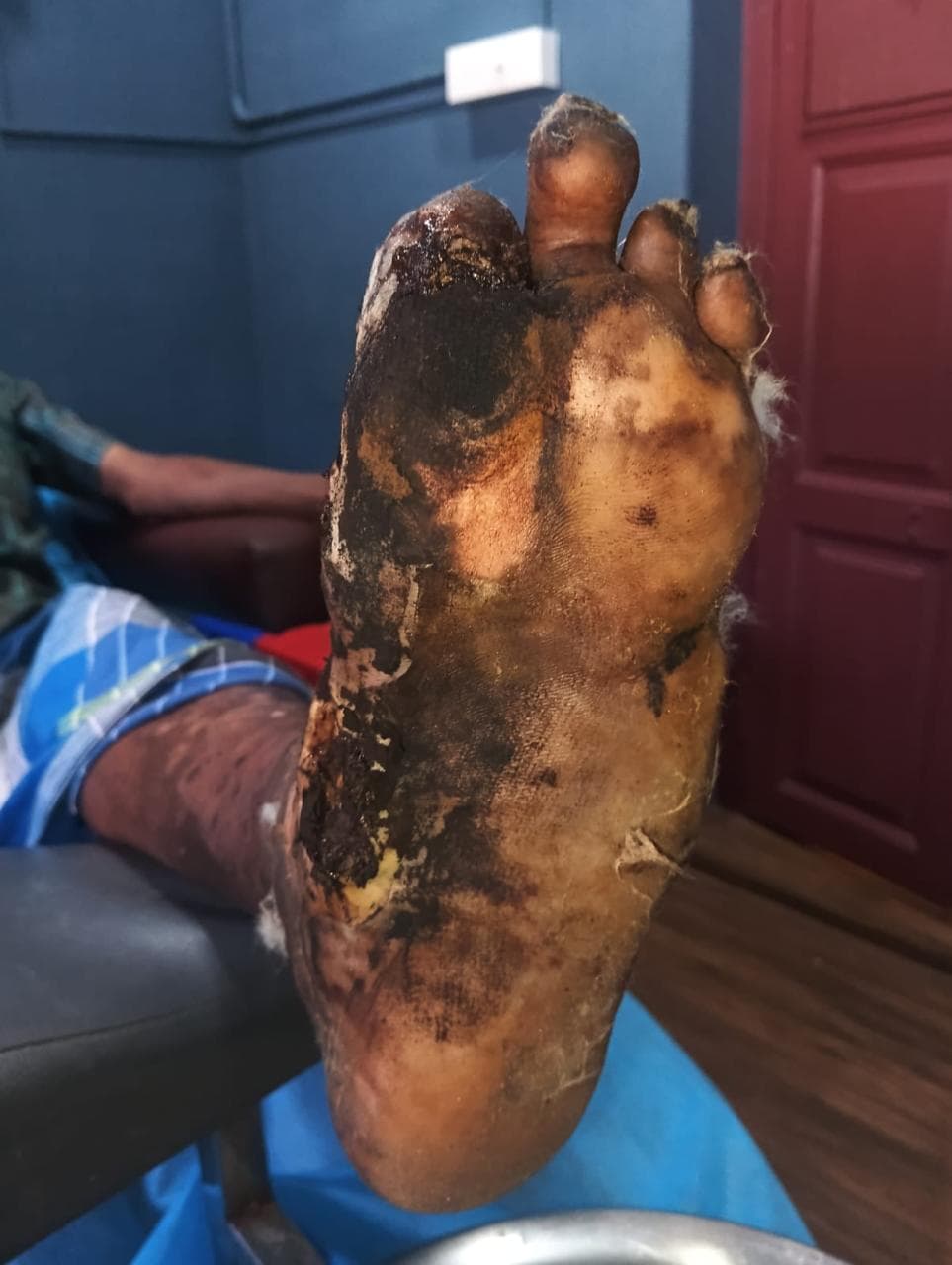 Clinical image 3 from Merina Medical Centre case record