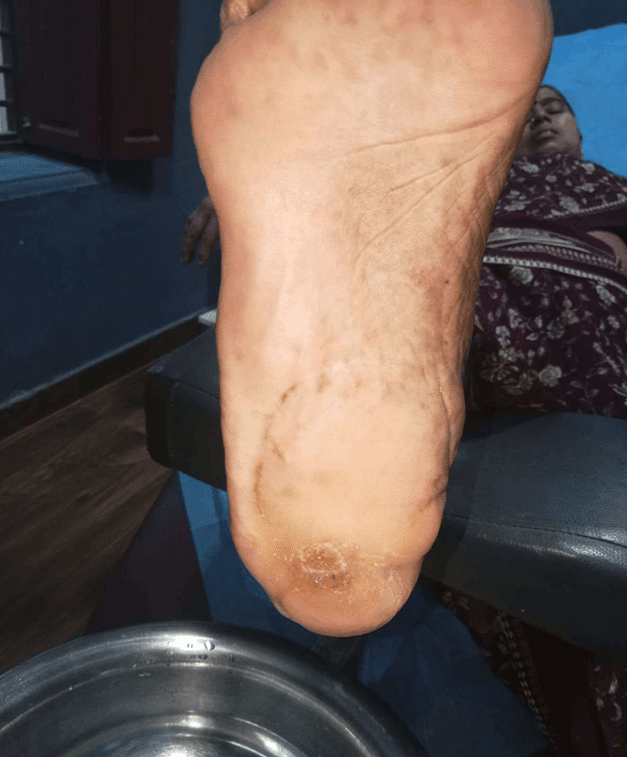Clinical image 3 from Merina Medical Centre case record