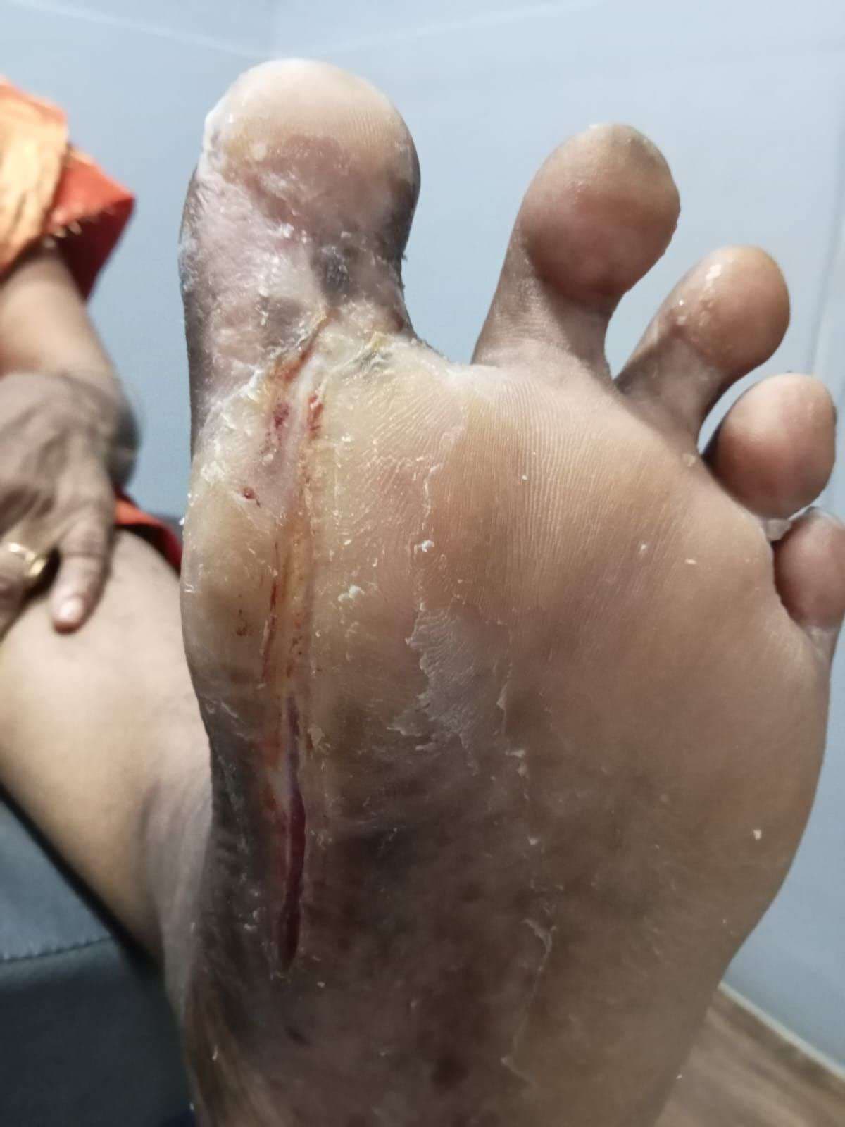 Clinical image 5 from Merina Medical Centre case record