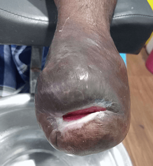 Clinical image 7 from Merina Medical Centre case record