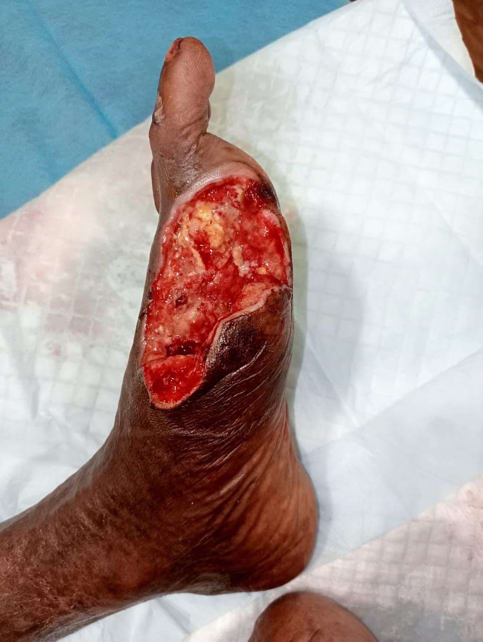 Clinical image 4 from Merina Medical Centre case record