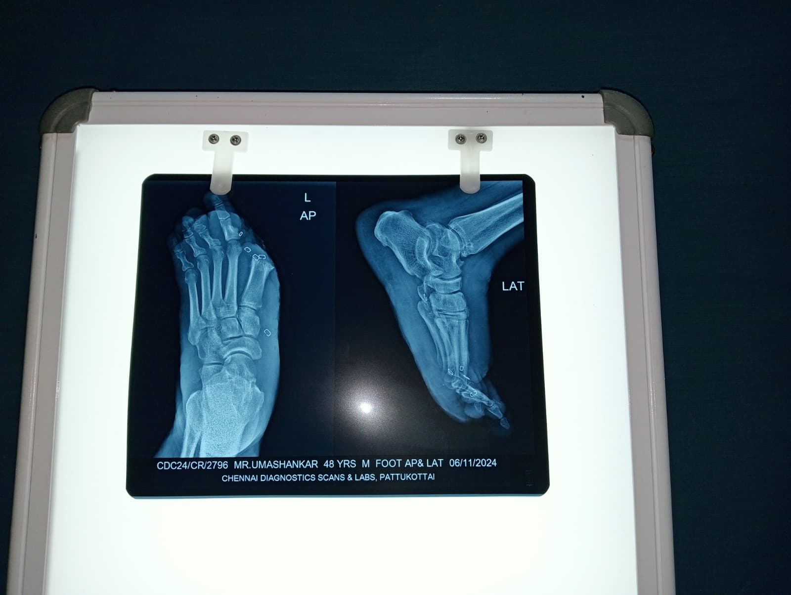 Clinical image 3 from Merina Medical Centre case record