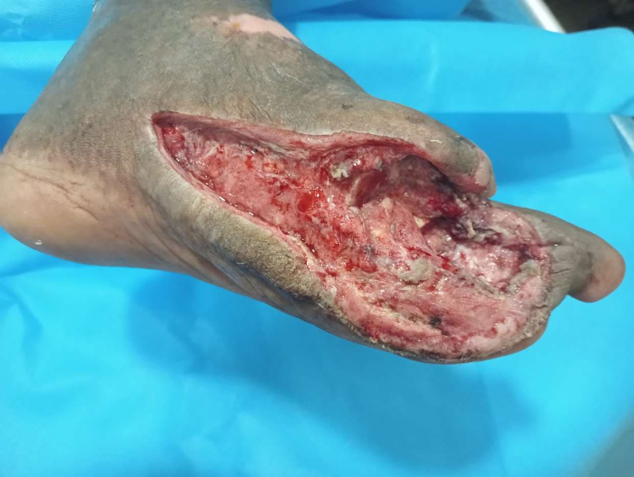 Clinical image 4 from Merina Medical Centre case record