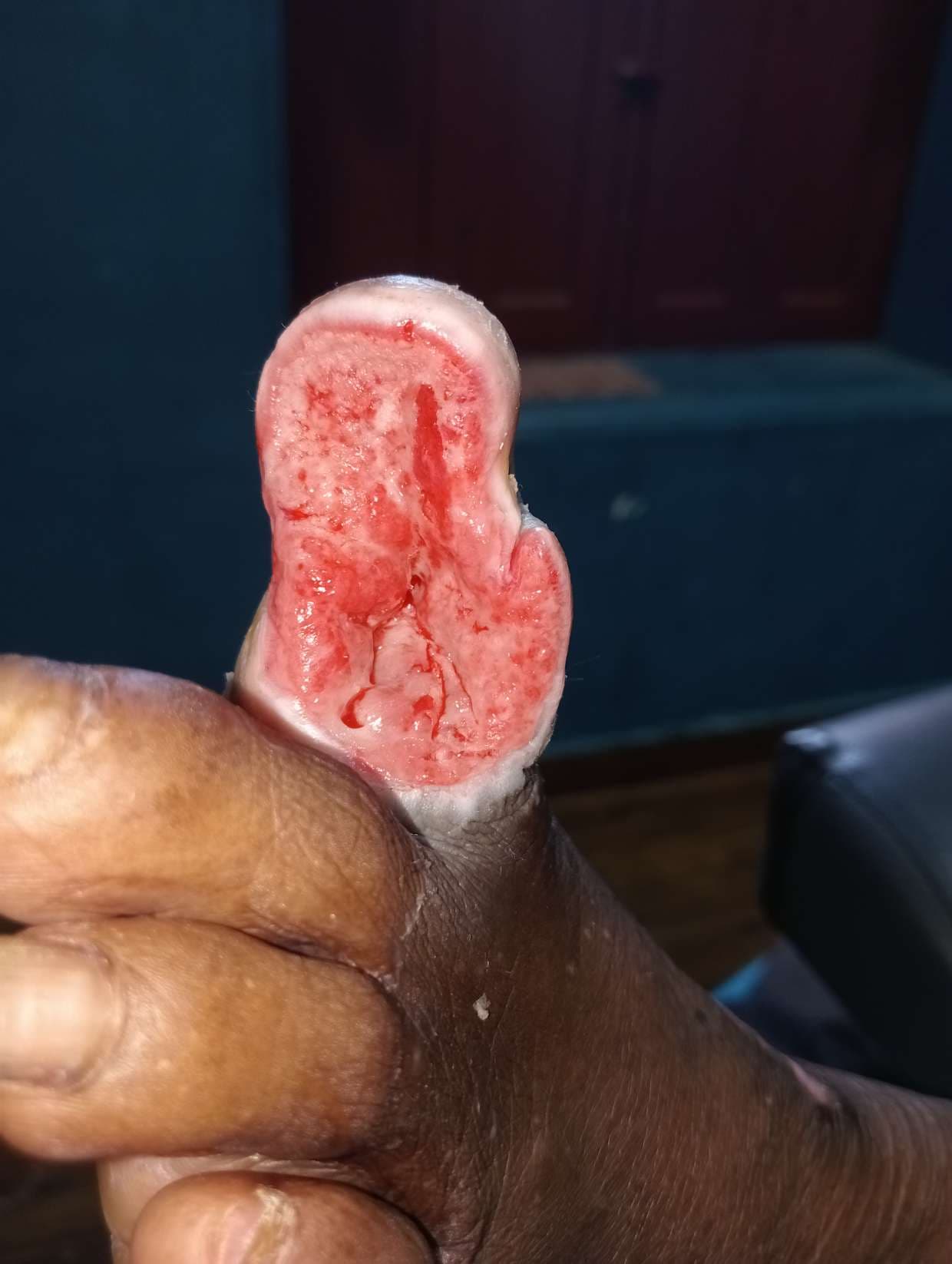 Clinical image 3 from Merina Medical Centre case record