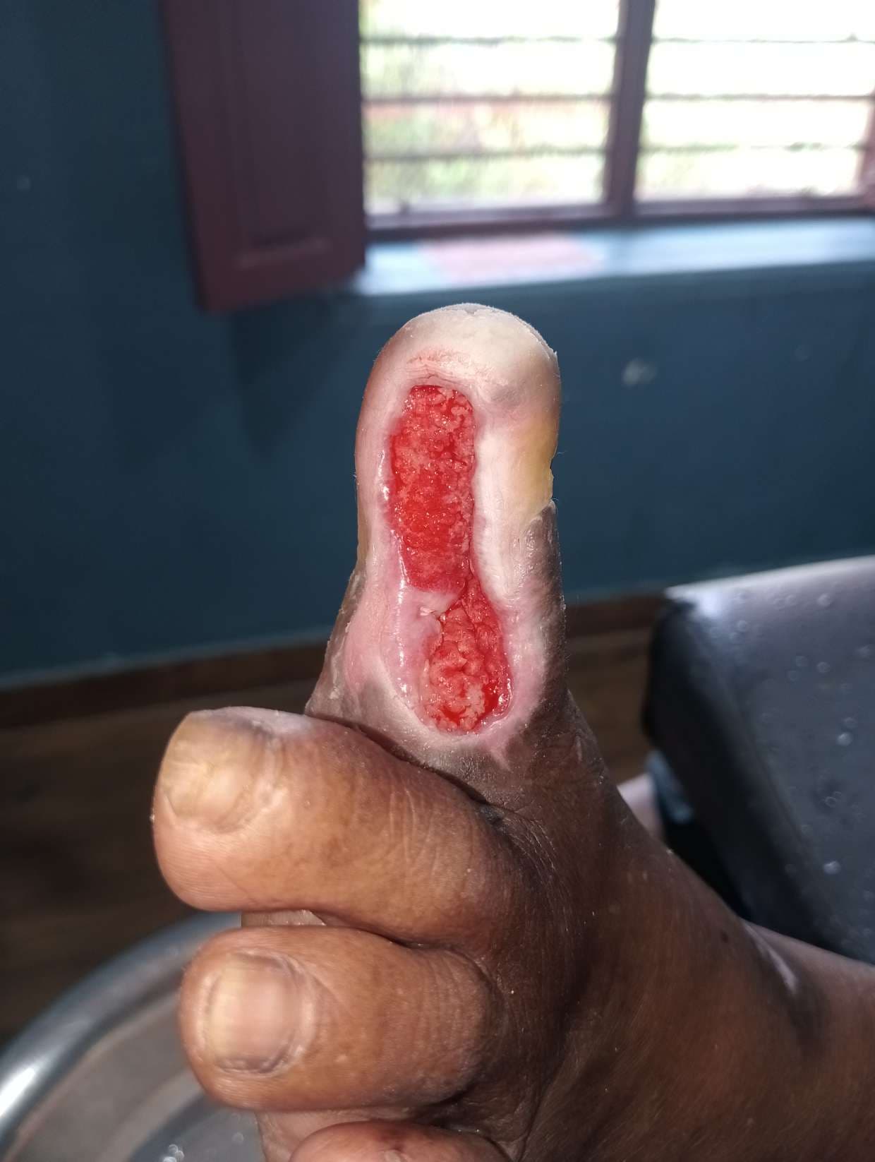 Clinical image 4 from Merina Medical Centre case record