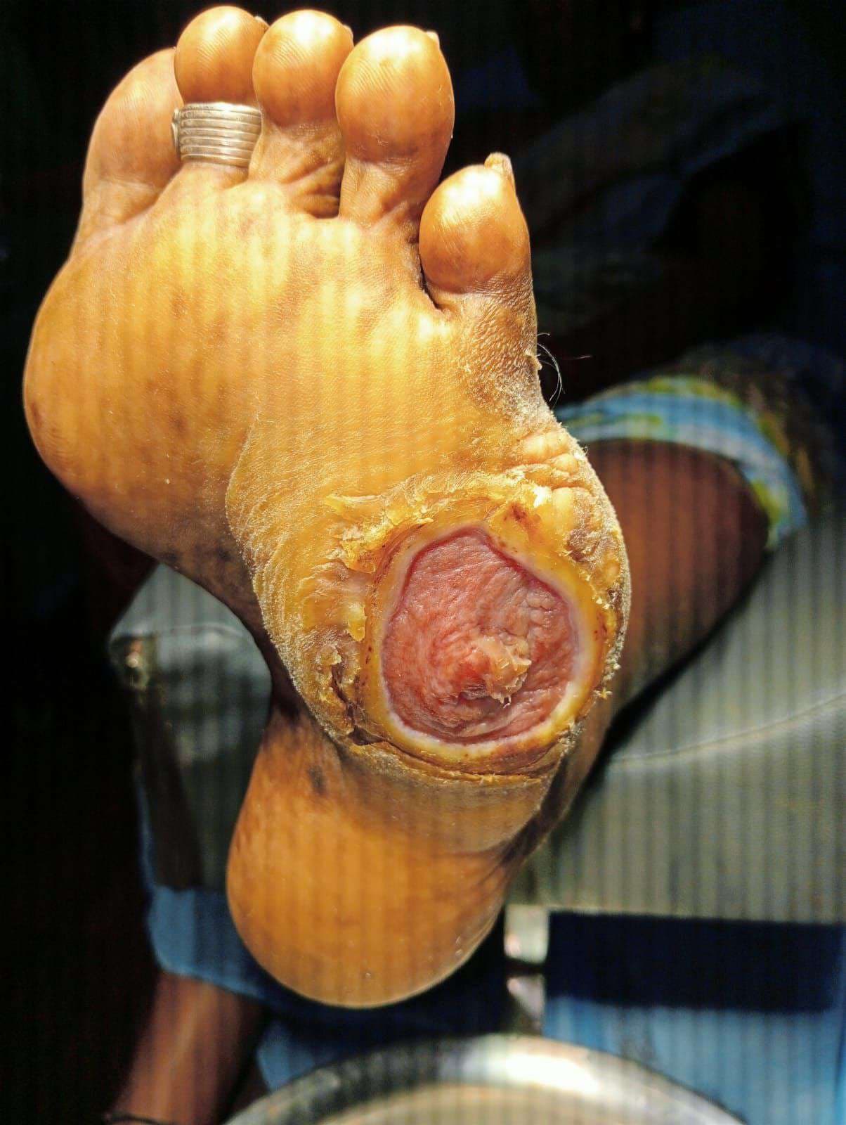 Clinical image 1 from Merina Medical Centre case record