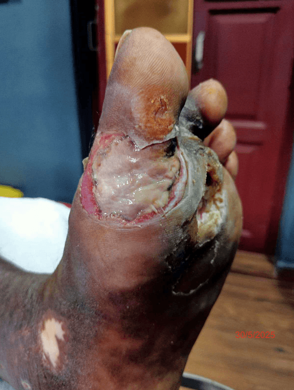 Clinical image 1 from Merina Medical Centre case record