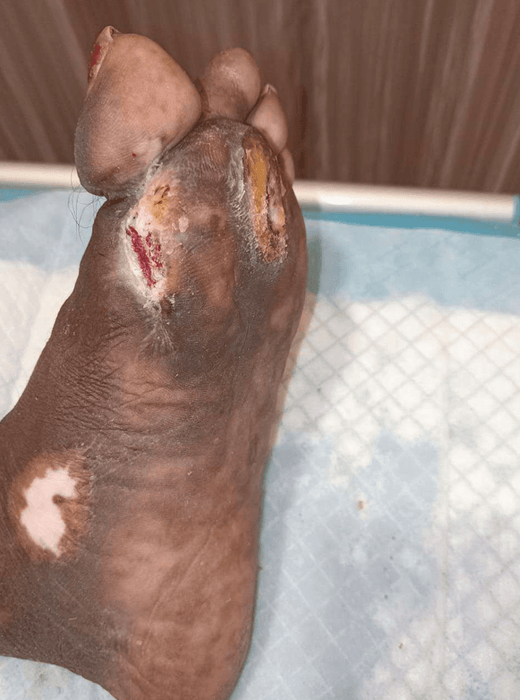 Clinical image 2 from Merina Medical Centre case record