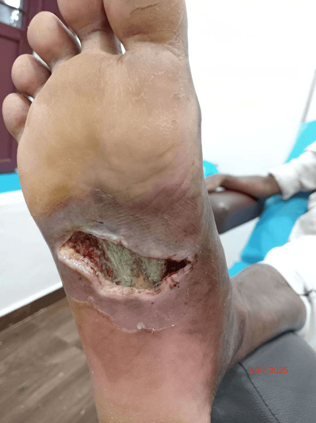 Clinical image 2 from Merina Medical Centre case record