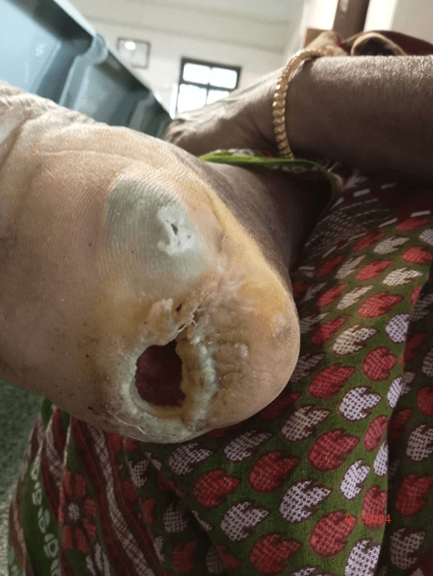 Clinical image 1 from Merina Medical Centre case record