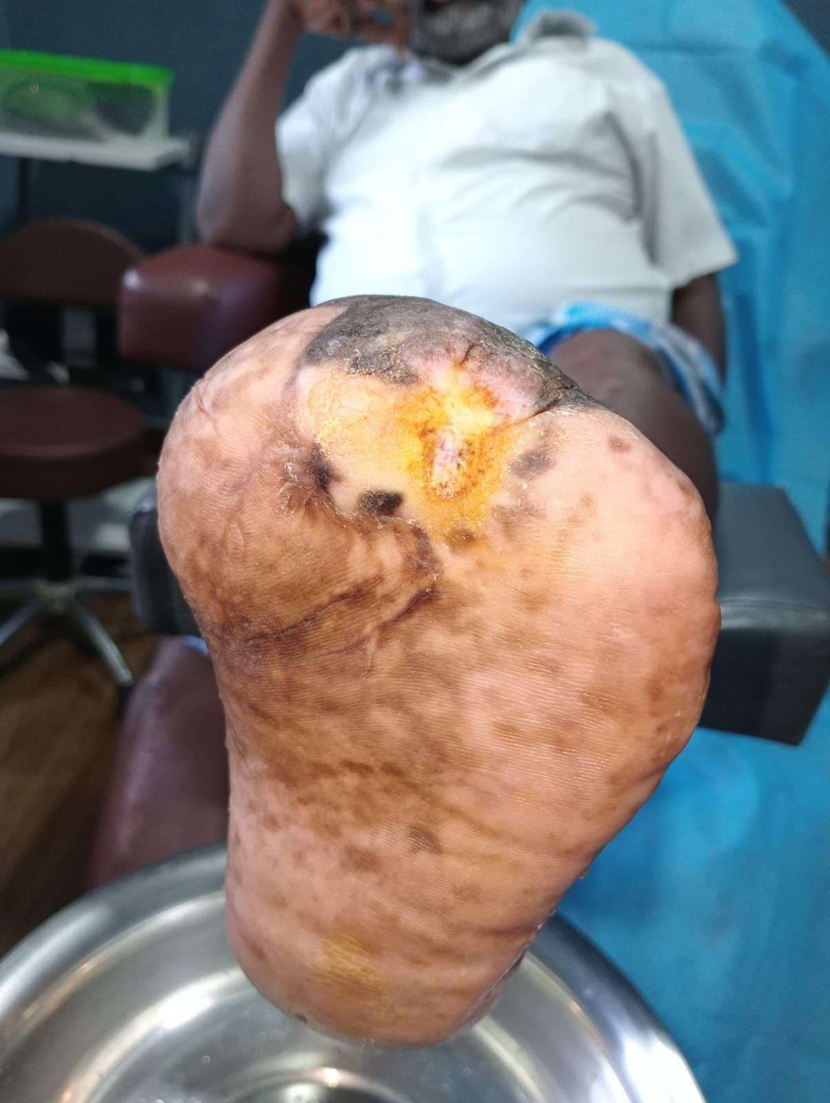 Clinical image 2 from Merina Medical Centre case record