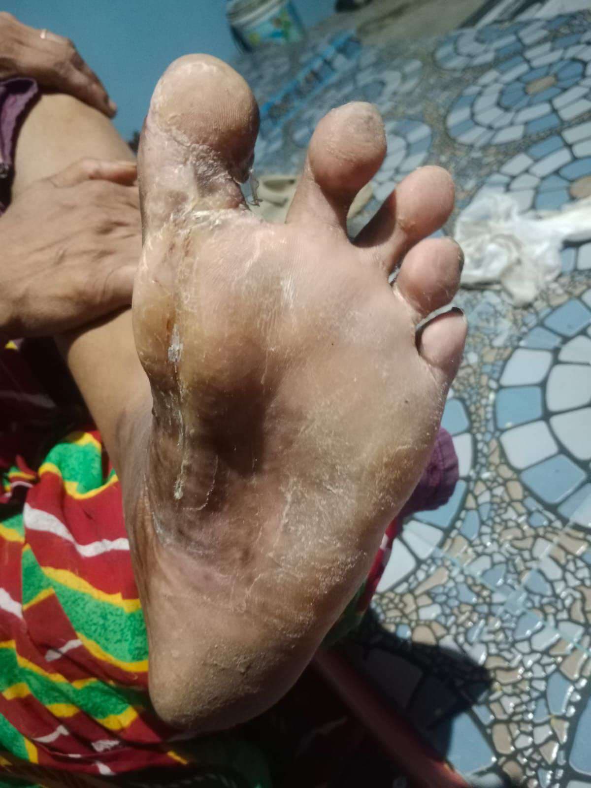 Clinical image 2 from Merina Medical Centre case record