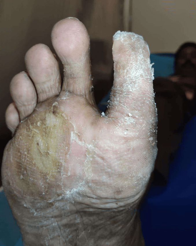 Clinical image 5 from Merina Medical Centre case record
