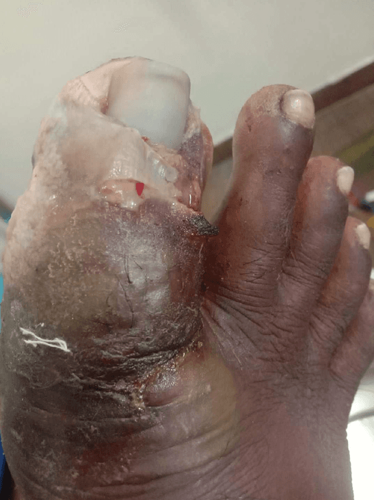 Clinical image 6 from Merina Medical Centre case record