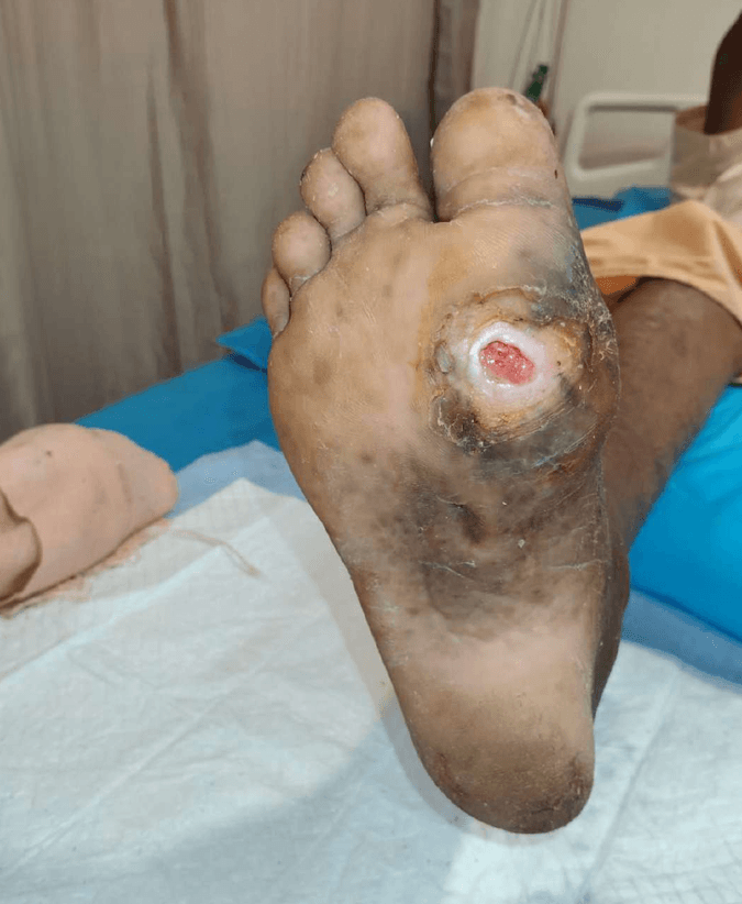 Clinical image 3 from Merina Medical Centre case record