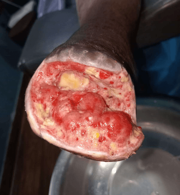 Clinical image 2 from Merina Medical Centre case record