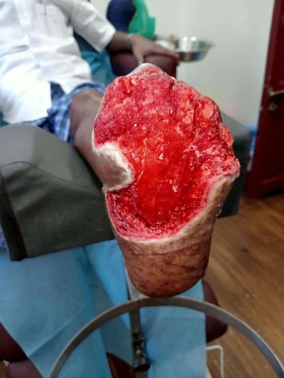 Clinical image 2 from Merina Medical Centre case record