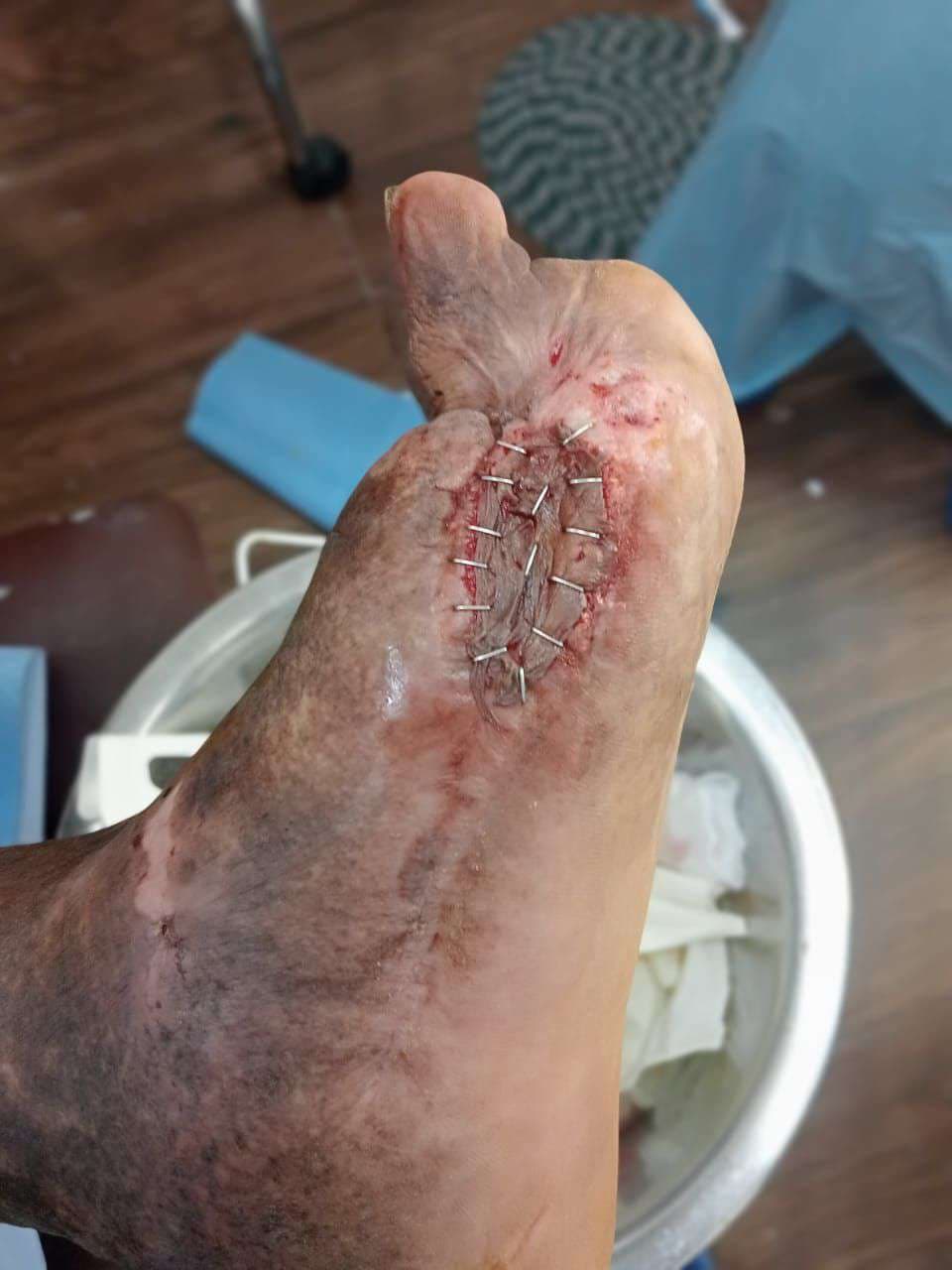 Clinical image 2 from Merina Medical Centre case record