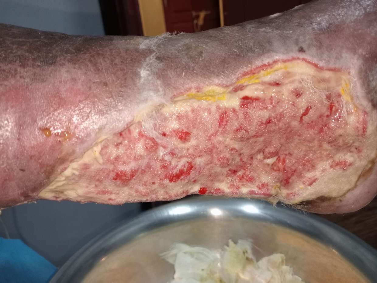 Clinical image 1 from Merina Medical Centre case record