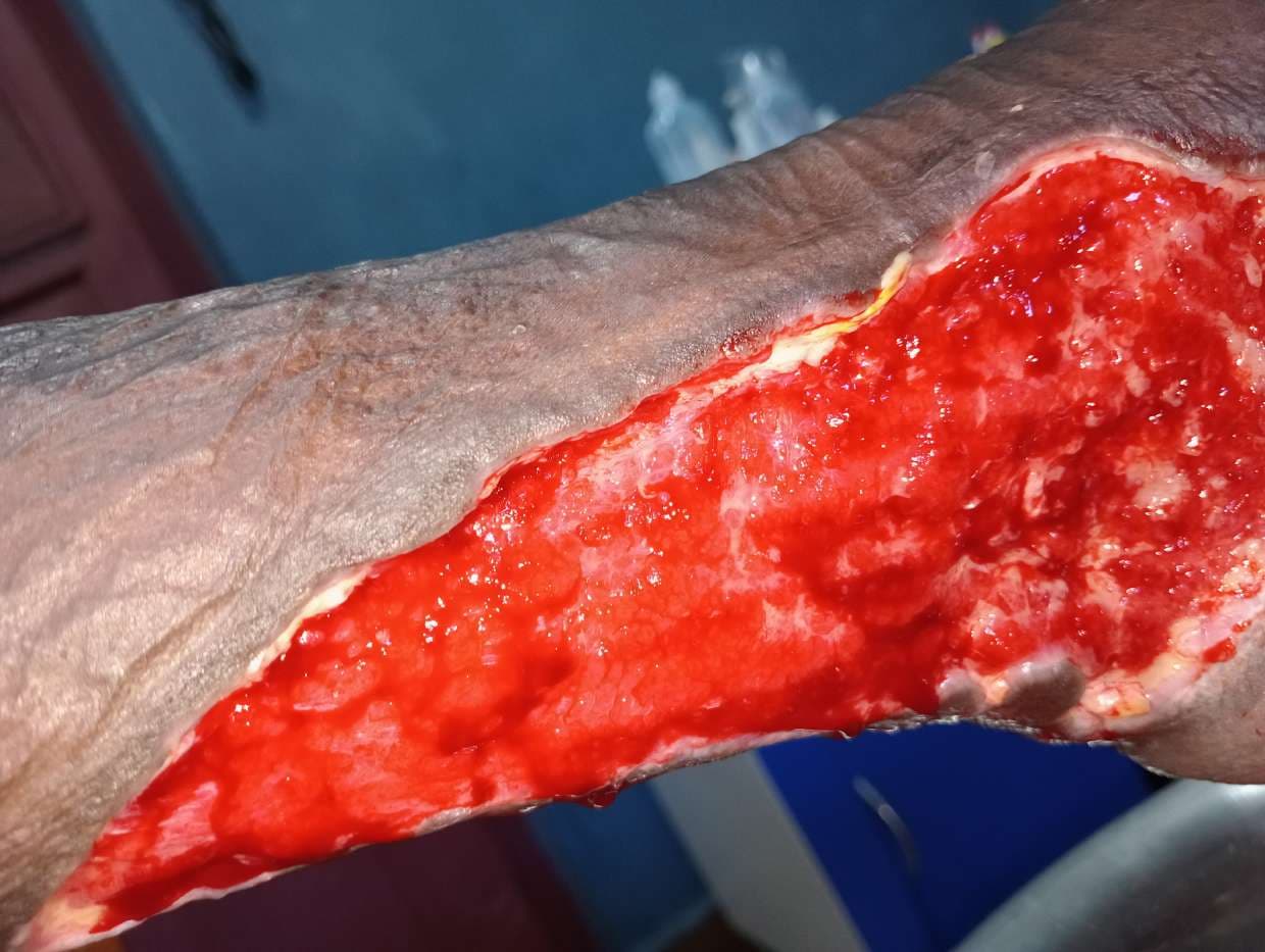 Clinical image 5 from Merina Medical Centre case record