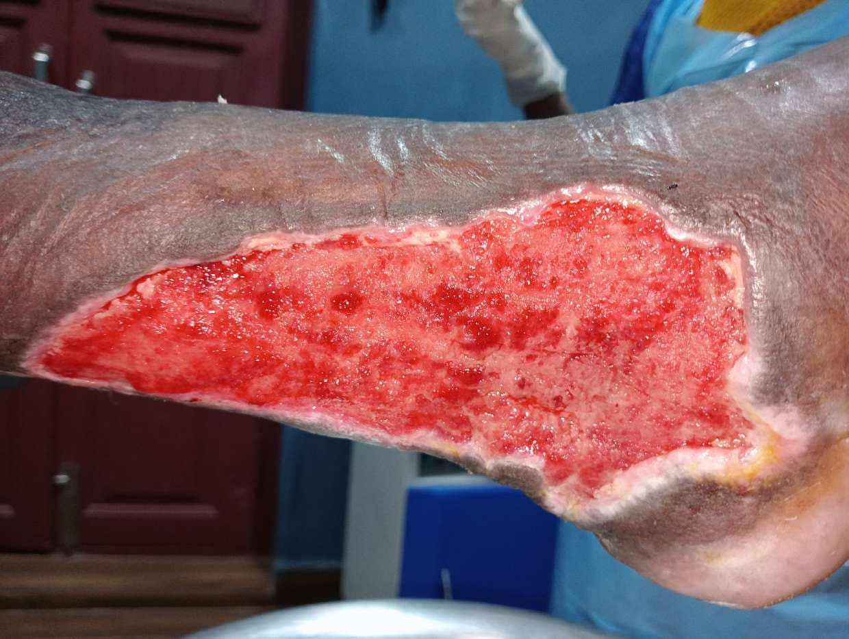 Clinical image 6 from Merina Medical Centre case record