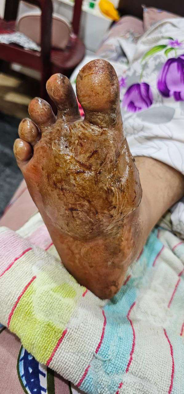Clinical image 1 from Merina Medical Centre case record